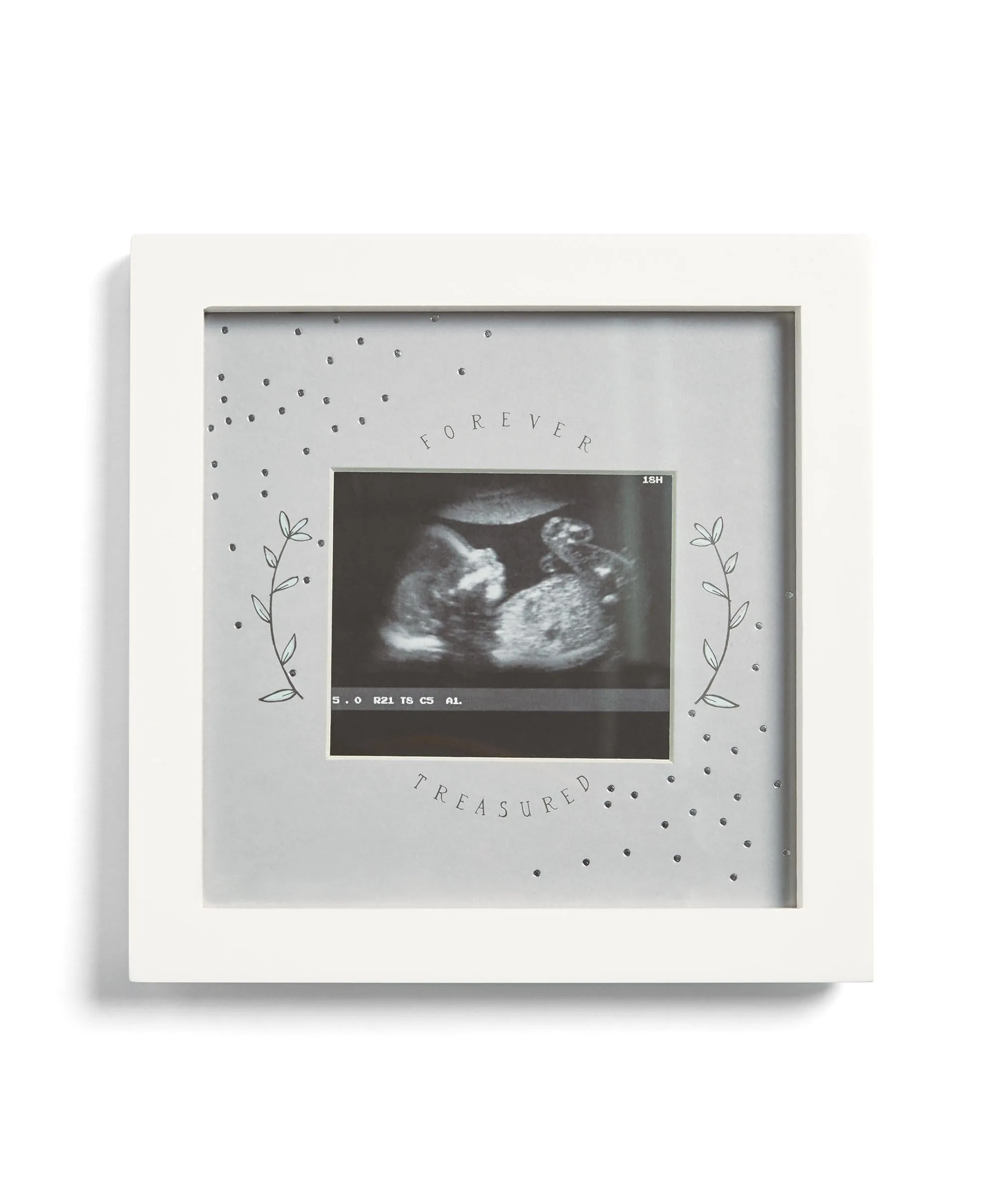 Baby Scan Photo Frame White - Forever Treasured